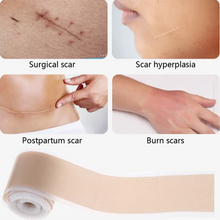 Silicone Gel Scar Patch