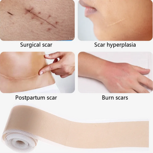 Silicone Gel Scar Patch