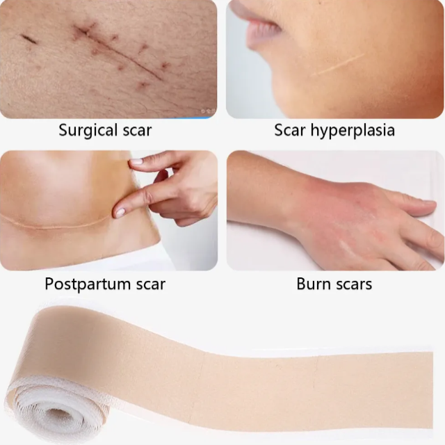 Silicone Gel Scar Patch