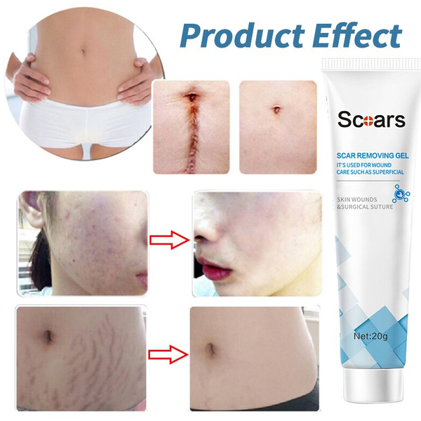 微Scar removal gel
