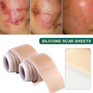 Silicone Scar Patch Removal