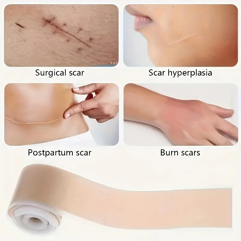 scar away silicone gel (3)