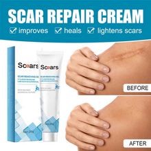 Scar Removal Gel