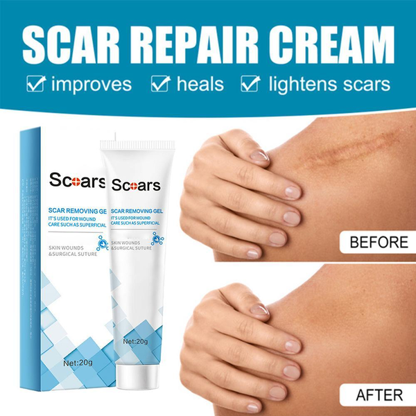 Scar Removal Gel