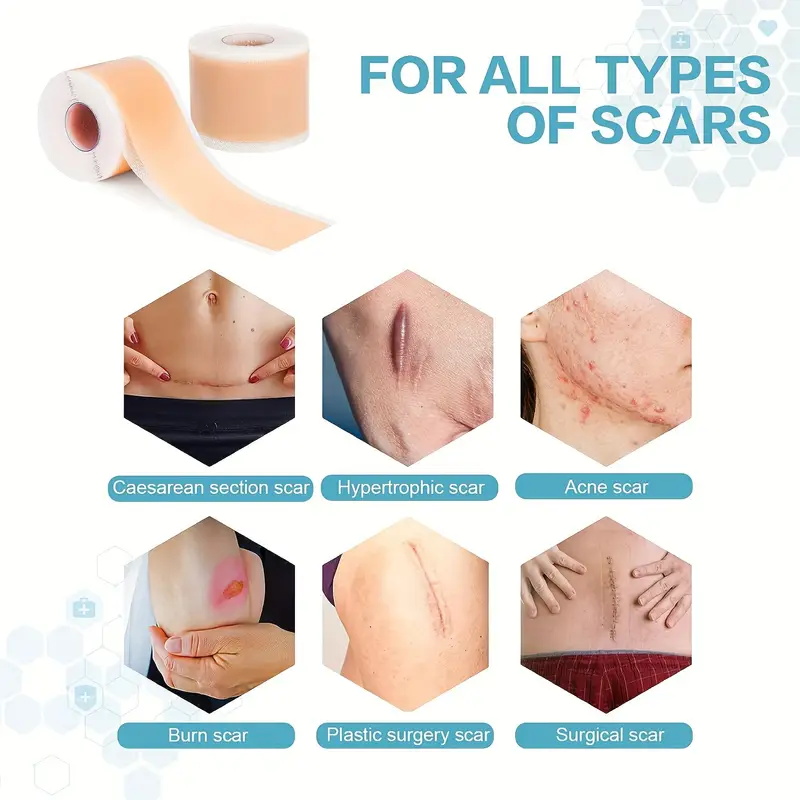 silicone stickers for scars (5)