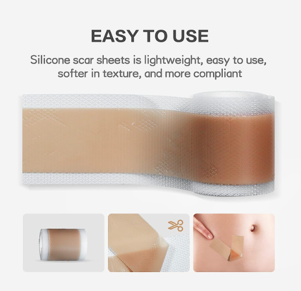 Silicone Sheets for Facial Scars