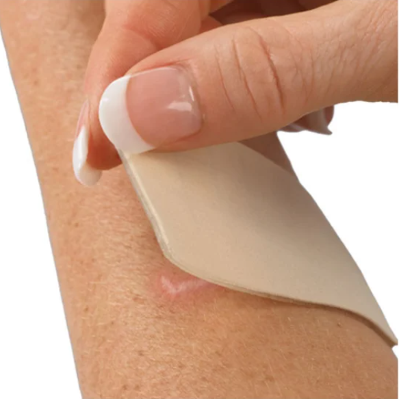 The Best Silicone Scar Stickers