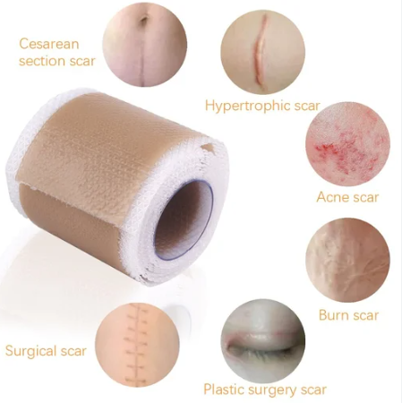 Scar Removal Patch